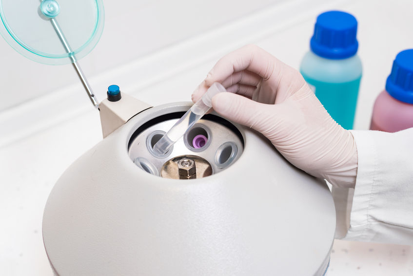Application example laboratory automation: Centrifuge